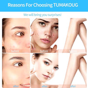 Portable Handheld High Frequency Skin Therapy Wand Machine for Acne Massage Skin Rejuvenation Tightening Wrinkle Reducing Tool